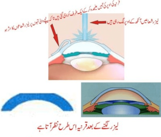 What is nature of operation? What kind of changes are created?