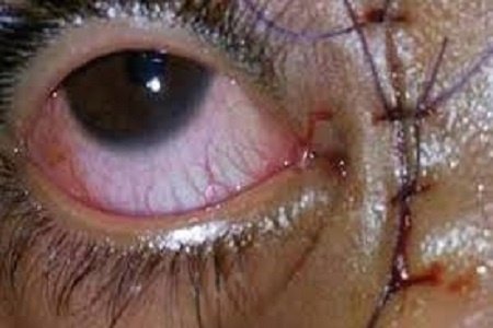 What changes do you make by DCR operation?